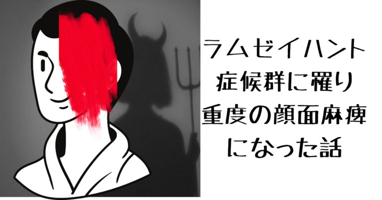 ラムゼイハント症候群で顔面麻痺になった話のアイキャッチ画像